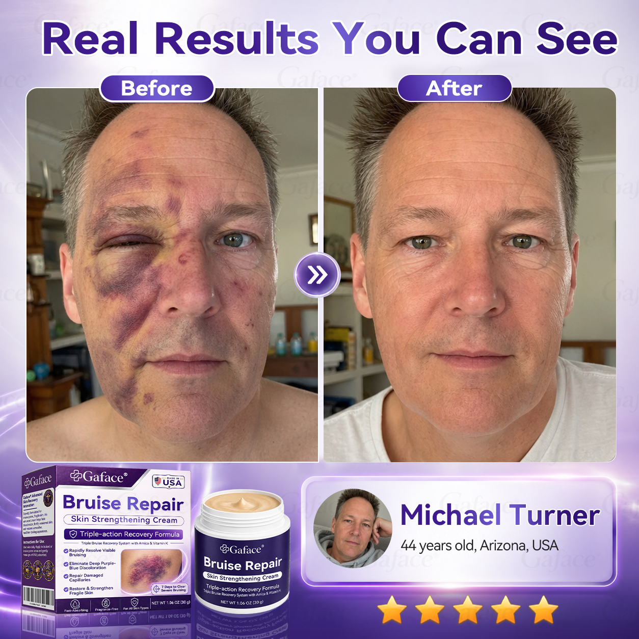𝑮𝒂𝒇𝒂𝒄𝒆® 𝑩𝒓𝒖𝒊𝒔𝒆 𝑹𝒆𝒑𝒂𝒊𝒓 & 𝑺𝒌𝒊𝒏-𝑺𝒕𝒓𝒆𝒏𝒈𝒕𝒉𝒆𝒏𝒊𝒏𝒈 𝑪𝒓𝒆𝒂𝒎 ⏰Enjoy an exclusive 30% discount⏰