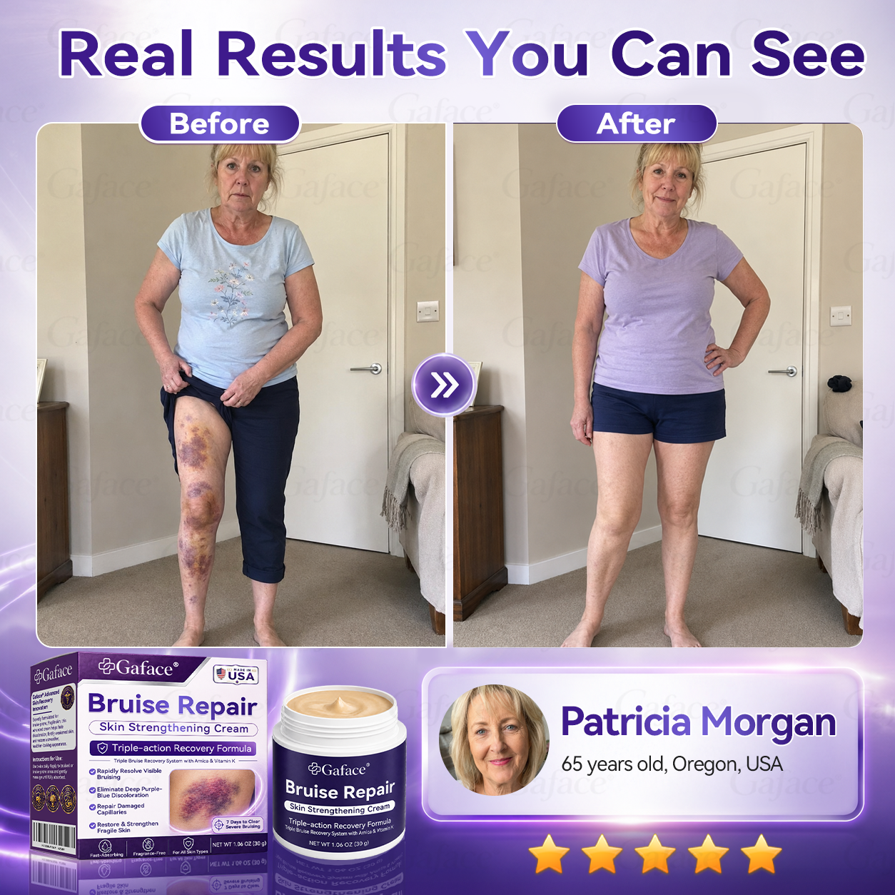 𝑮𝒂𝒇𝒂𝒄𝒆® 𝑩𝒓𝒖𝒊𝒔𝒆 𝑹𝒆𝒑𝒂𝒊𝒓 & 𝑺𝒌𝒊𝒏-𝑺𝒕𝒓𝒆𝒏𝒈𝒕𝒉𝒆𝒏𝒊𝒏𝒈 𝑪𝒓𝒆𝒂𝒎 ⏰Enjoy an exclusive 30% discount⏰