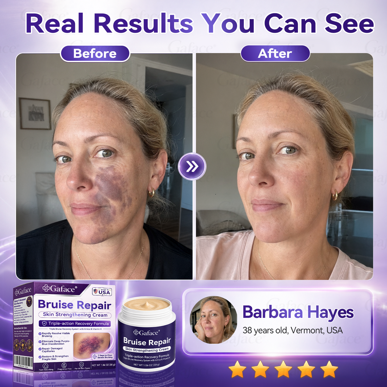 𝑮𝒂𝒇𝒂𝒄𝒆® 𝑩𝒓𝒖𝒊𝒔𝒆 𝑹𝒆𝒑𝒂𝒊𝒓 & 𝑺𝒌𝒊𝒏-𝑺𝒕𝒓𝒆𝒏𝒈𝒕𝒉𝒆𝒏𝒊𝒏𝒈 𝑪𝒓𝒆𝒂𝒎 ⏰Enjoy an exclusive 30% discount⏰
