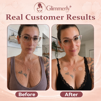 【As seen on celebrities】𝐆𝐥𝐢𝐦𝐦𝐞𝐫𝐥𝐲® 𝐁𝐫𝐞𝐚𝐬𝐭 𝐕𝐨𝐥𝐮𝐦𝐞 𝐁𝐨𝐨𝐬𝐭 & 𝐅𝐢𝐫𝐦 𝐌𝐢𝐜𝐫𝐨-𝐍𝐞𝐞𝐝𝐥𝐞 𝐏𝐚𝐭𝐜𝐡𝐞𝐬🎑py)