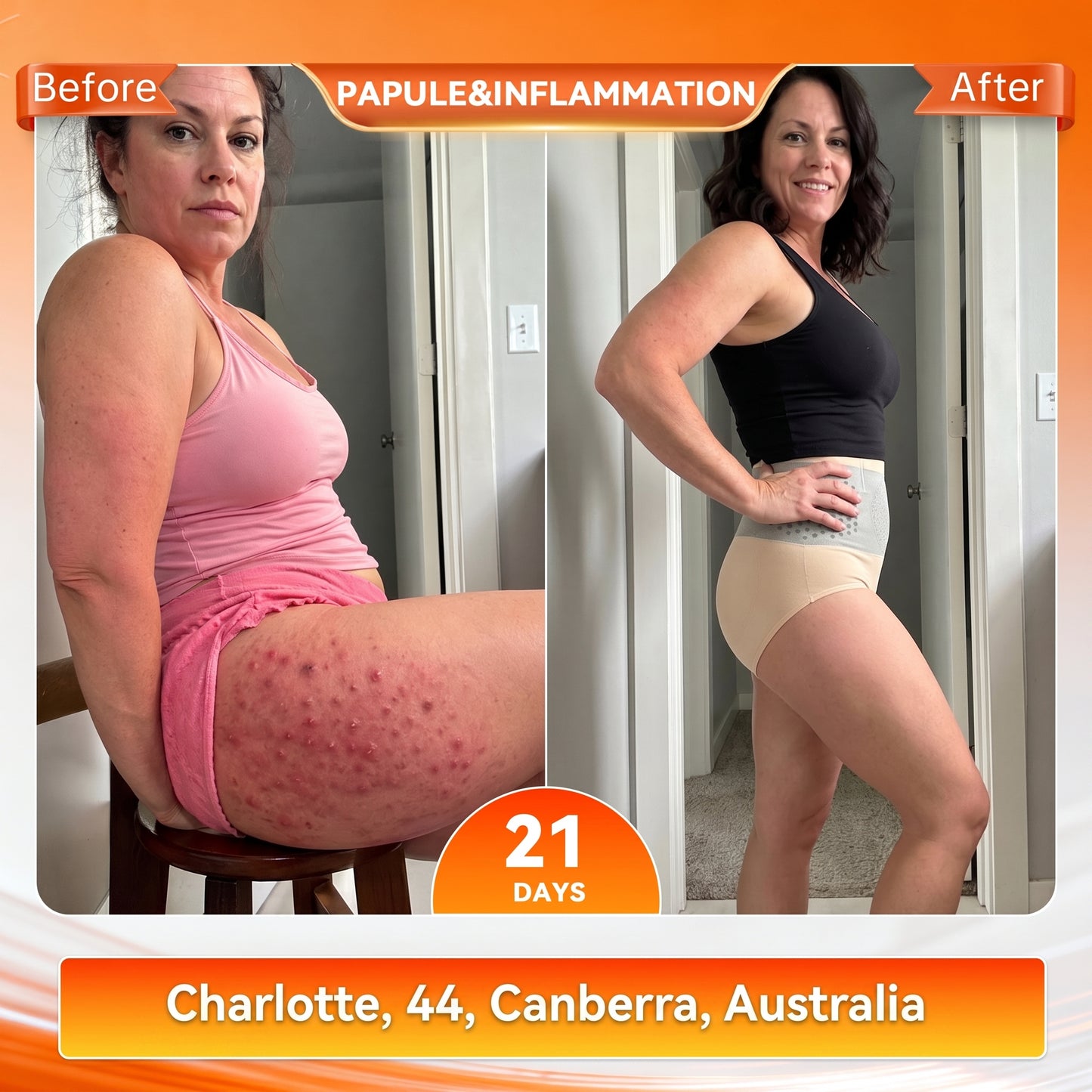 𝐎𝐟𝐟𝐢𝐜𝐢𝐚𝐥 𝐁𝐫𝐚𝐧𝐝 𝐒𝐭𝐨𝐫𝐞 |🏅 𝐏𝐀𝐔𝐑𝐀𝐉𝐔® 𝟐𝟎𝟐𝟔 𝐌𝐨𝐫𝐢𝐧𝐠𝐚 & 𝐁𝐞𝐫𝐛𝐞𝐫𝐢𝐧𝐞 𝟒-𝐈𝐧-𝟏 𝐌𝐢𝐜𝐫𝐨-𝐏𝐚𝐫𝐭𝐢𝐜𝐥𝐞 𝐒𝐜𝐮𝐥𝐩𝐭𝐢𝐧𝐠 & 𝐅𝐚𝐭-𝐁𝐮𝐫𝐧 𝐒𝐡𝐨𝐫𝐭𝐬🚗