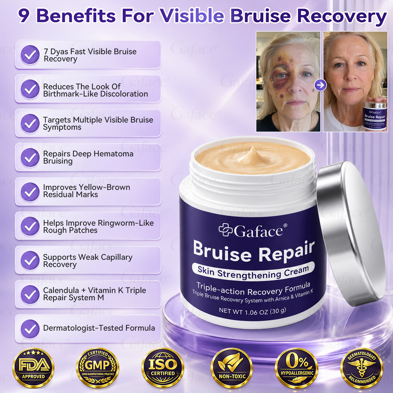 𝑮𝒂𝒇𝒂𝒄𝒆® 𝑩𝒓𝒖𝒊𝒔𝒆 𝑹𝒆𝒑𝒂𝒊𝒓 & 𝑺𝒌𝒊𝒏-𝑺𝒕𝒓𝒆𝒏𝒈𝒕𝒉𝒆𝒏𝒊𝒏𝒈 𝑪𝒓𝒆𝒂𝒎 ⏰Enjoy an exclusive 30% discount⏰