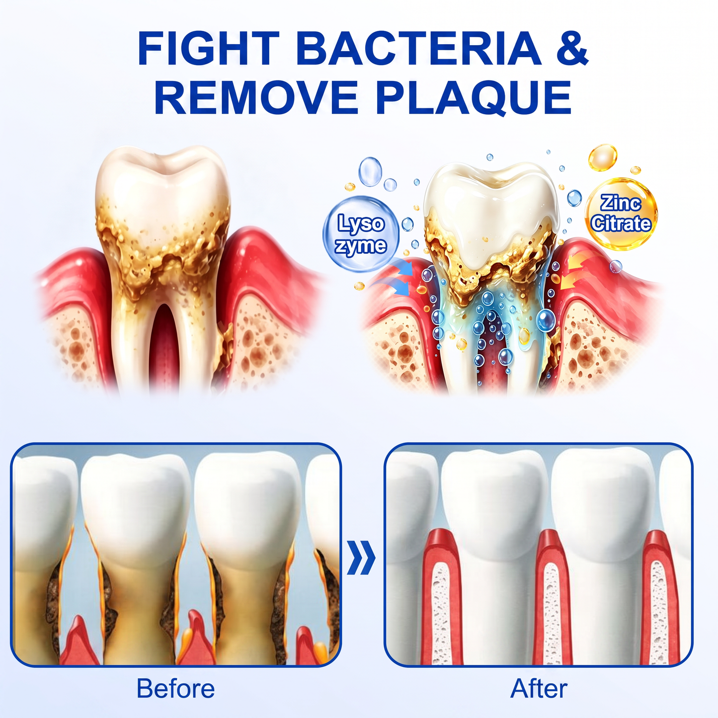 Glimmerly® 🦷GumRevive periodontal repair gel🌳