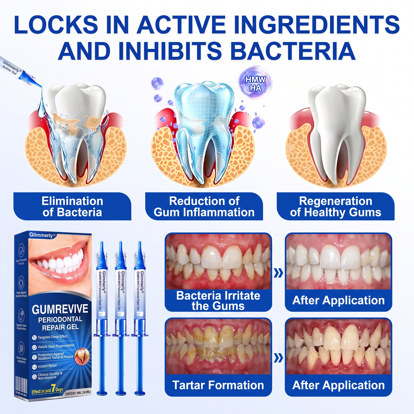 Glimmerly® 🦷GumRevive periodontal repair gel🌳
