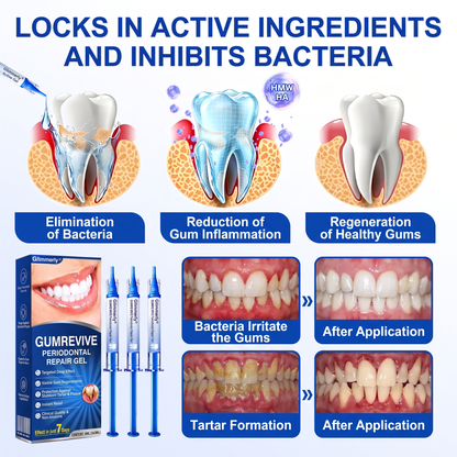 Glimmerly® 🦷GumRevive periodontal repair gel🌳