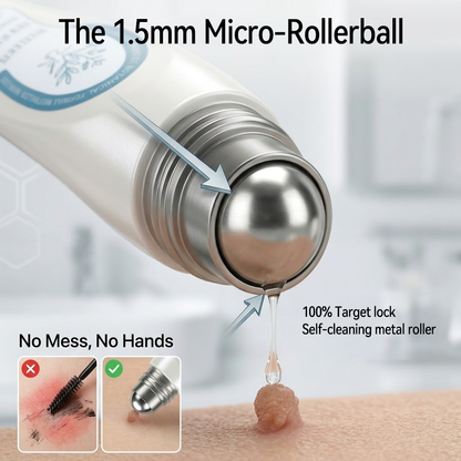 Official Store🎉𝐏i𝐜𝐝o® 7-𝐷𝑎𝑦 𝗧𝐚𝐠 & 𝗦𝗽𝐨𝐭 𝐄𝐫𝒂𝒔𝒆𝒓(Zero Pain, Zero 𝐒𝐜𝐚𝒓𝒔 Rollerball)